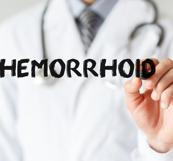 An Overview Of External Hemorrhoids- Causes, Symptoms, And Treatment