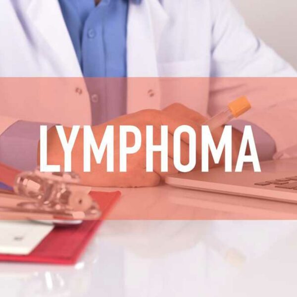 Best Treatment Options for Non Hodgkin Lymphoma