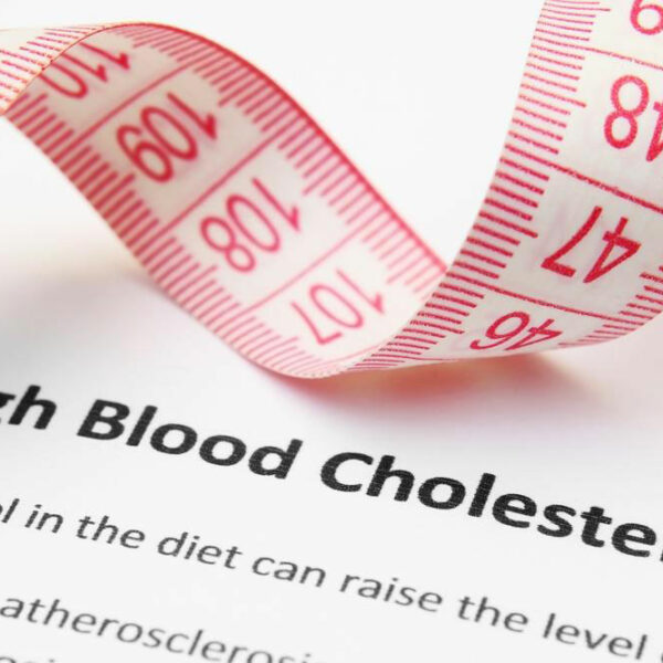 High Cholesterol &#8211; Symptoms and Treatment Options