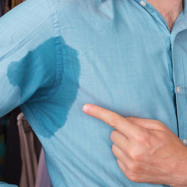 How to tackle excessive sweating