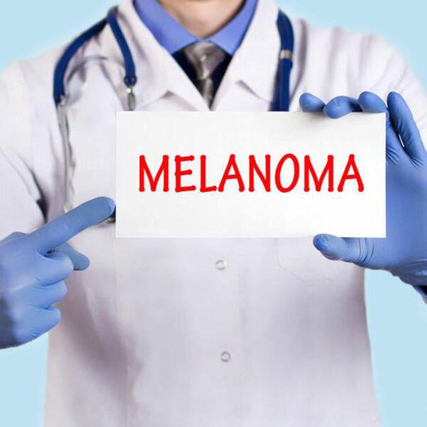 Know about the Diagnosis and Treatment Options for Metastatic Melanoma