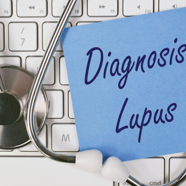 Know about the different ways to diagnose lupus