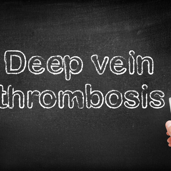 Simple tips to manage and ensure deep vein thrombosis prevention