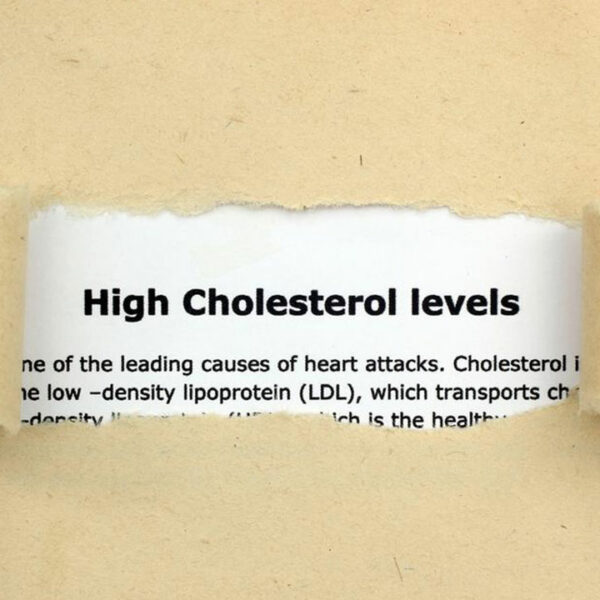 Things You Need to Know about Cholesterol Levels