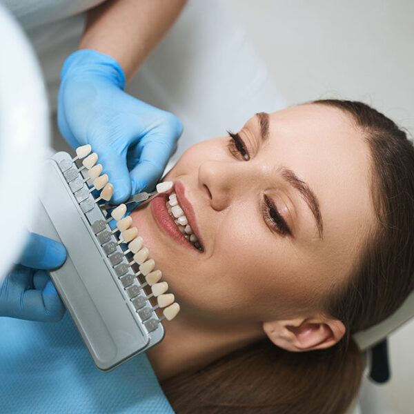 Things to know before opting for dental veneers