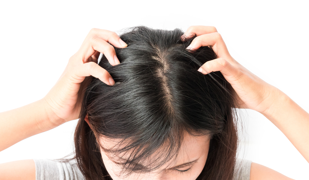 What To Know About Treating An Itchy Scalp