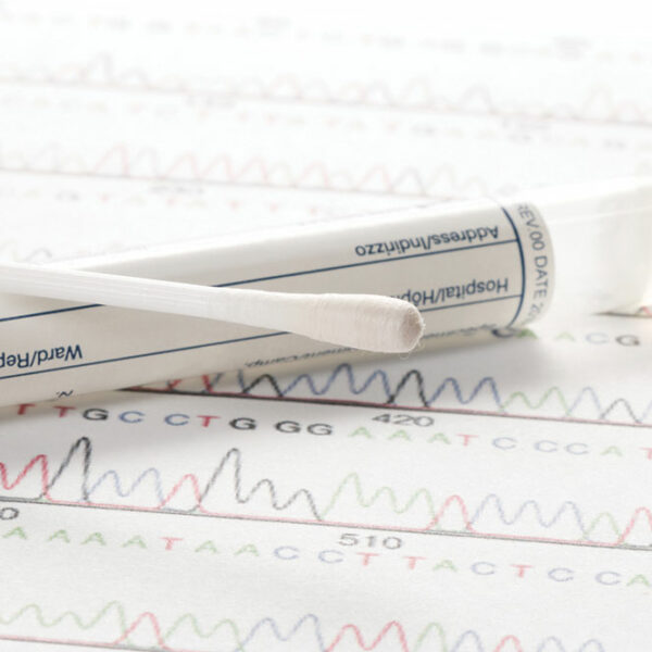 Where are large cotton swabs used