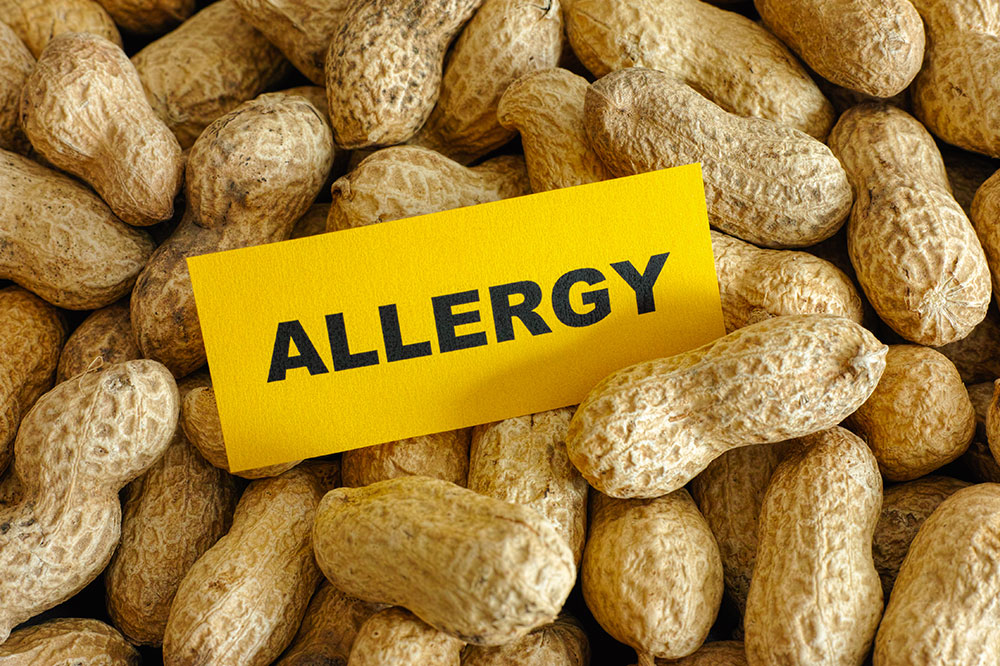 5 most common food allergies